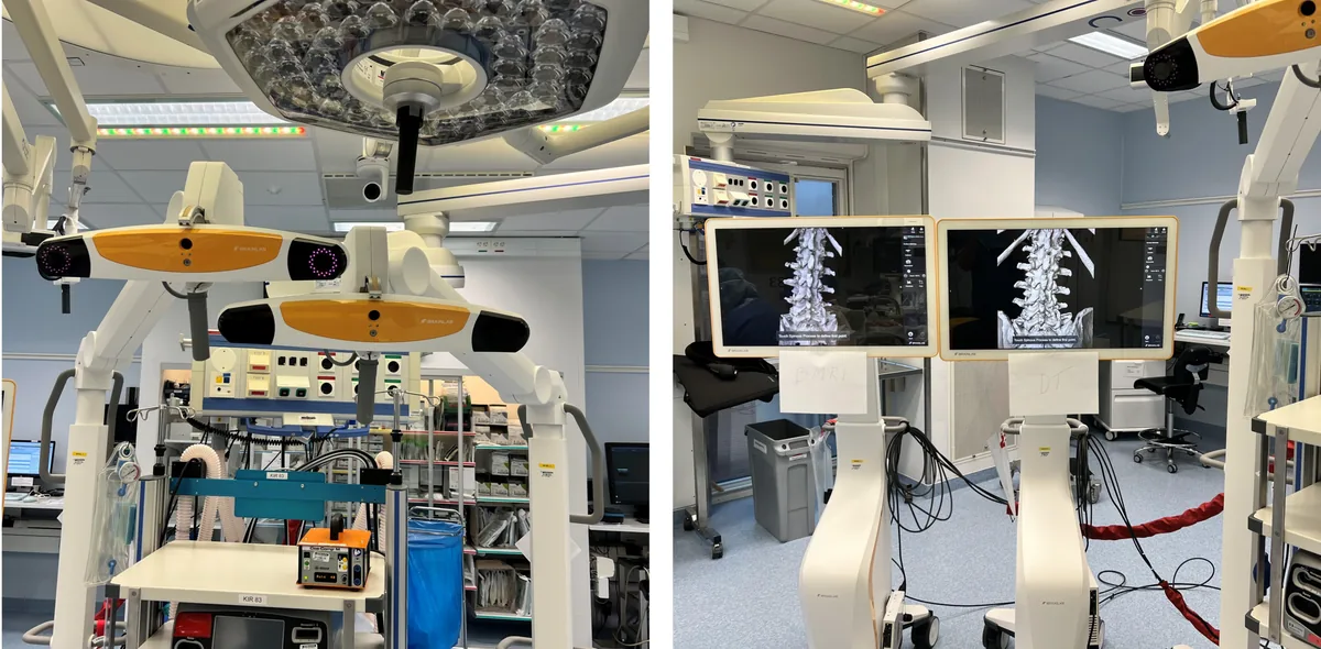 Fig 1) The dual navigation setup in the operation room. One system had the preoperative CT loaded, the other the sCT loaded as a shadow system.