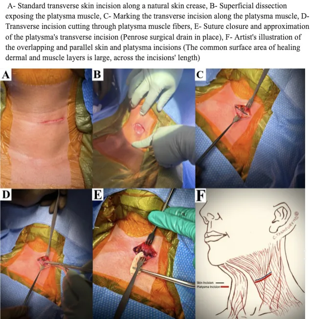 Figure 1 from the abstract