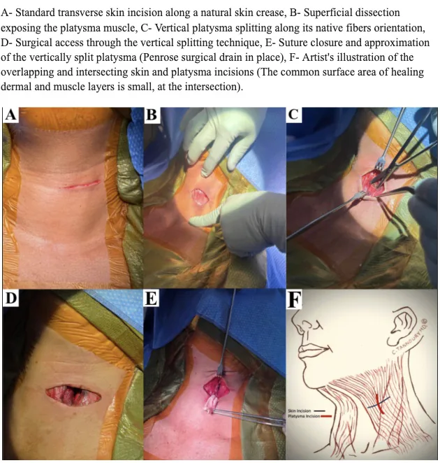 Figure 2 from the abstract