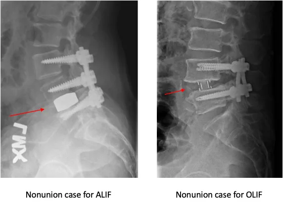 Figure 1 from the abstract