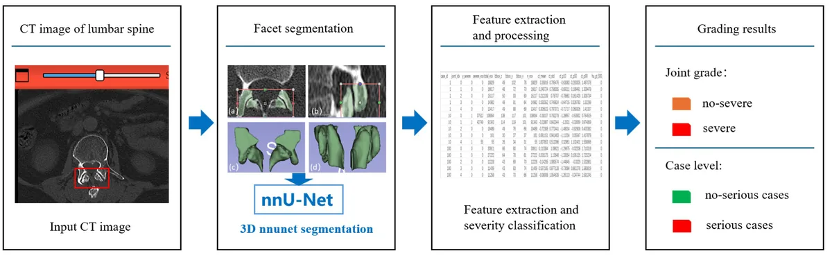 Figure 1. Overview of the proposed end-to-end framework for automated lumbar facet joint degeneration grading.Lumbar CT images were first processed using a 3D n