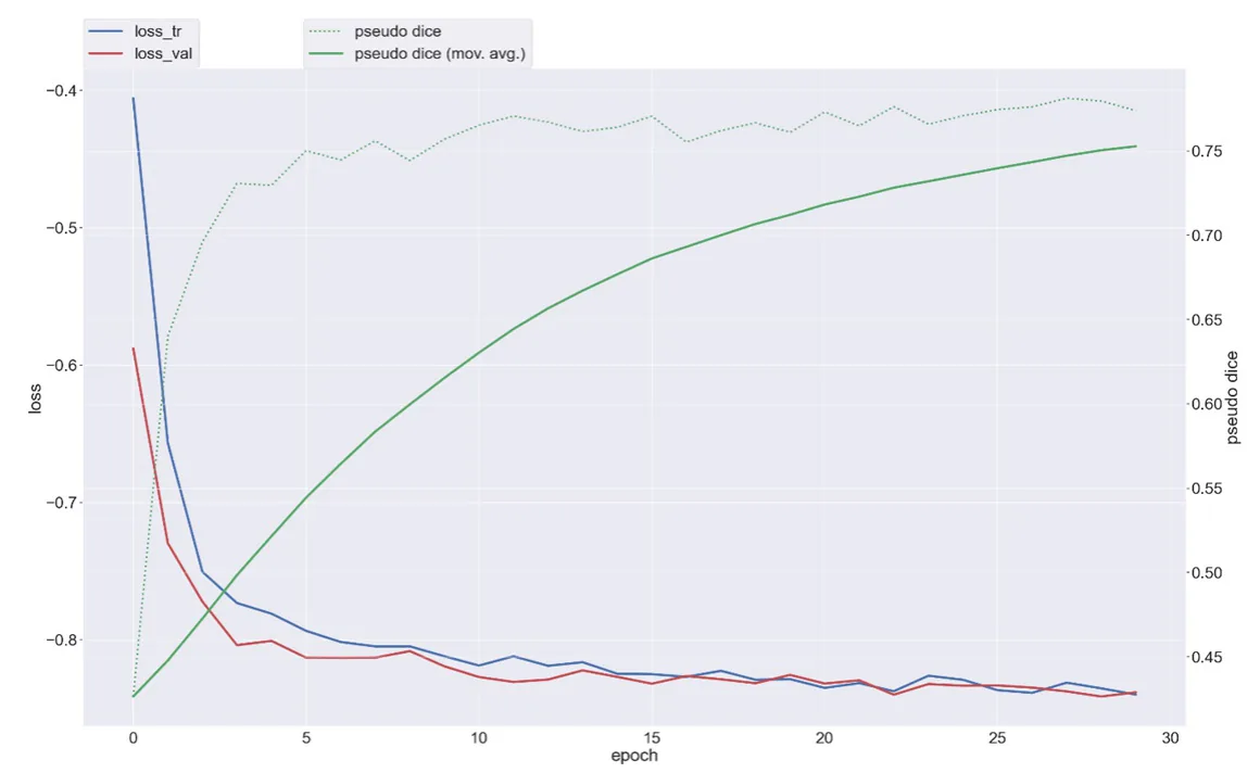 Figure 2. Training and validation performance of the 3D nnU-Net segmentation model.The training loss (blue) and validation loss (red) decreased steadily across 