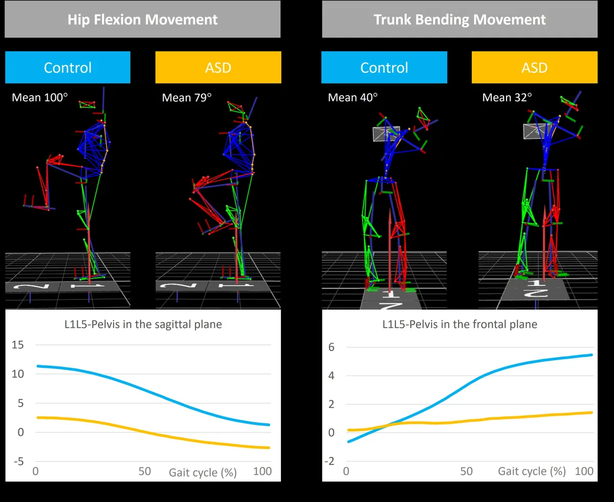 Figure 1: Trunk and hip movements in ASD compared to controls.
