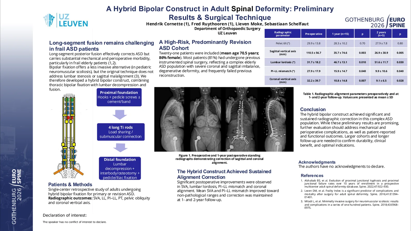 Poster 000177: The Hybrid Bipolar Construct in Adult Spinal Deformity: Preliminary Results & Surgical Technique