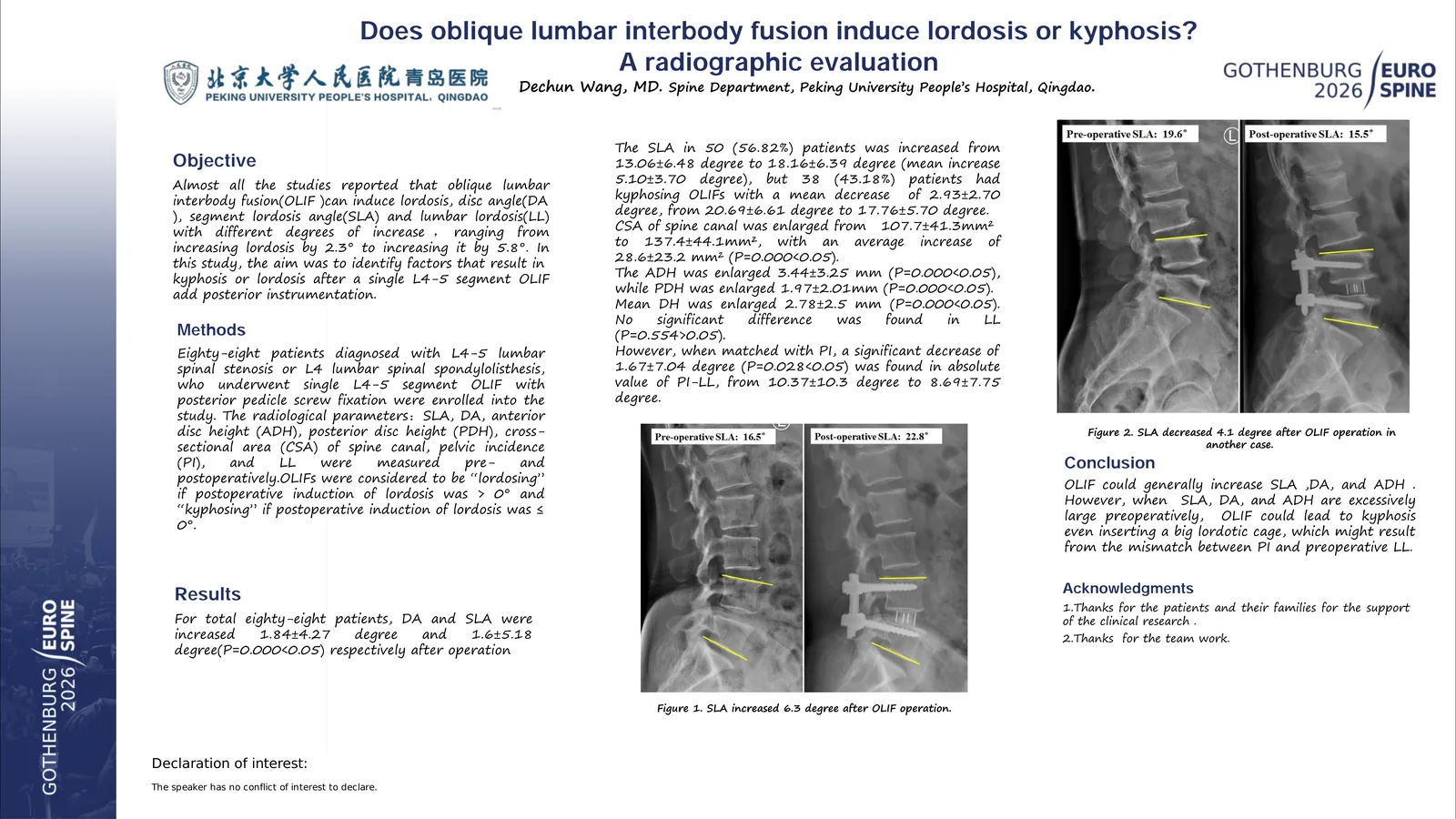 Poster 000194: Does oblique lumbar interbody fusion induce lordosis or kyphosis?