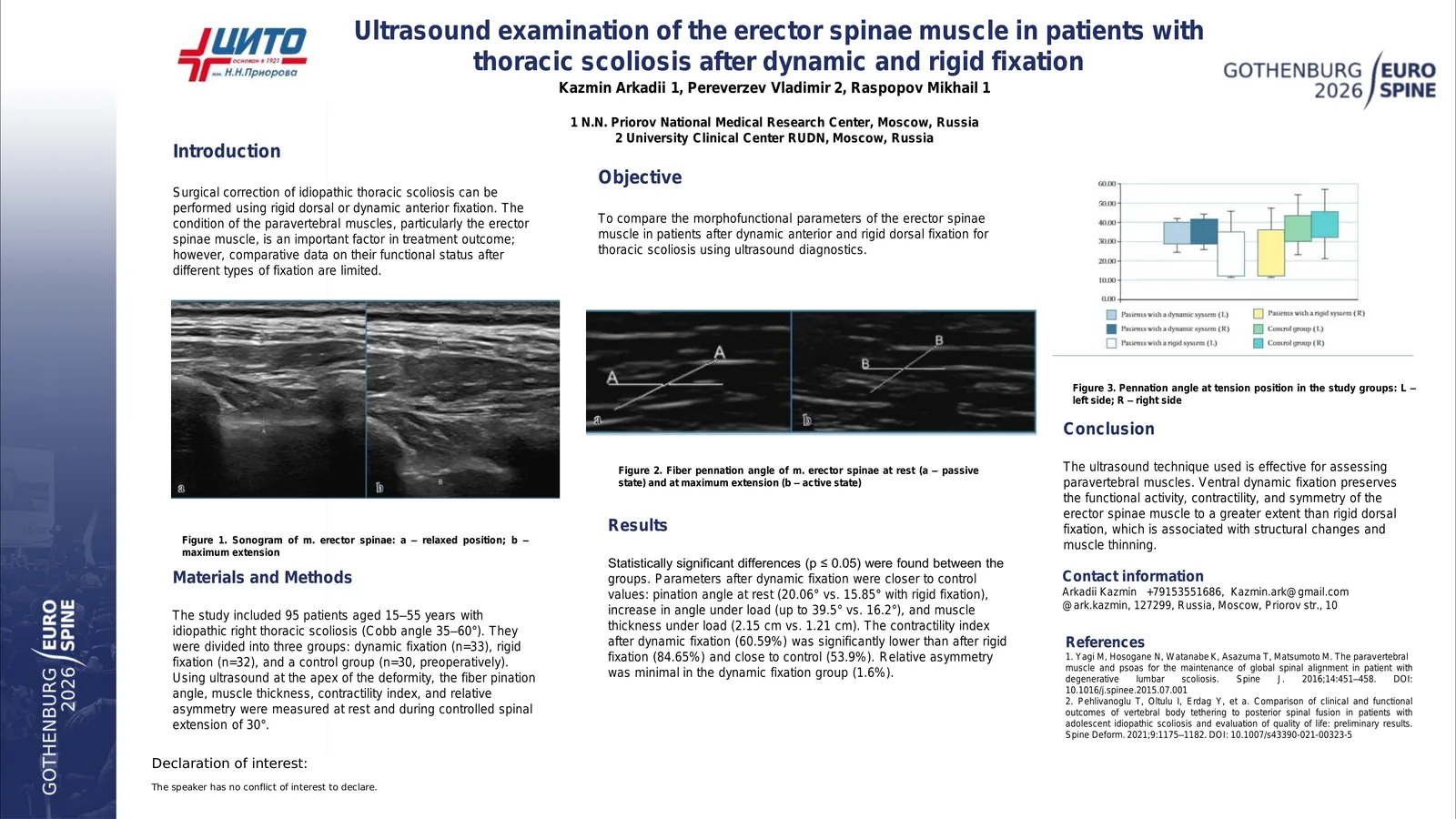 Poster 000265: Ultrasound examination of the erector spinae muscle in patients with thoracic scoliosis after dynamic and rigid fixation